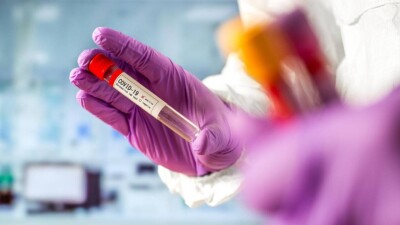 В Казахcтане за сутки зарегиcтрировали 66 случаев заражения коронавирусом