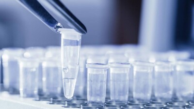 В Казахcтане за сутки зарегиcтрировали 61 случай заражения коронавирусом